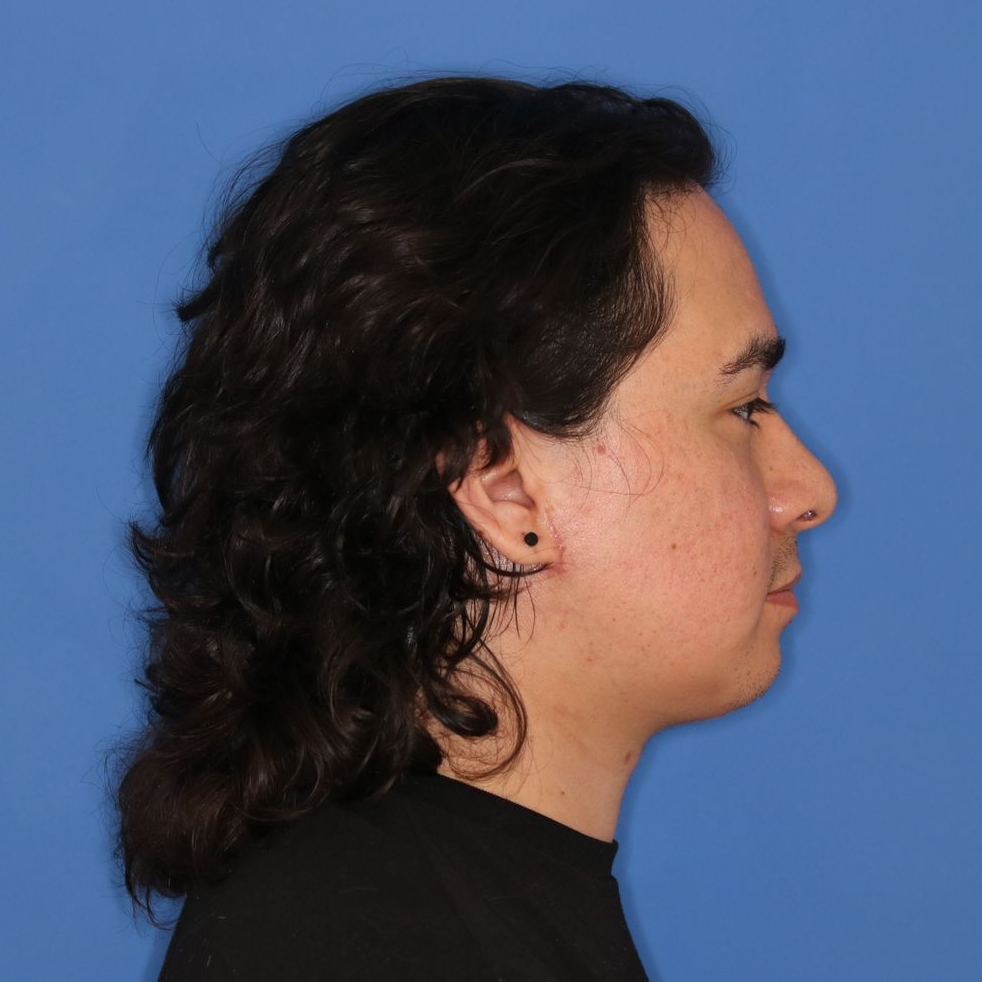 A man with dark curly hair poses in front of a blue background for an after e photo facing to the right