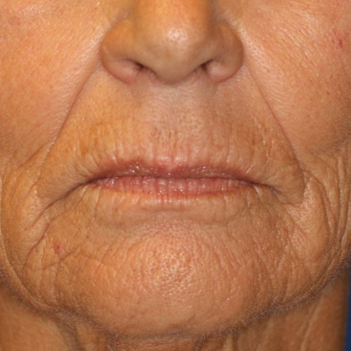 A close up of a woman 's face with a blue background.