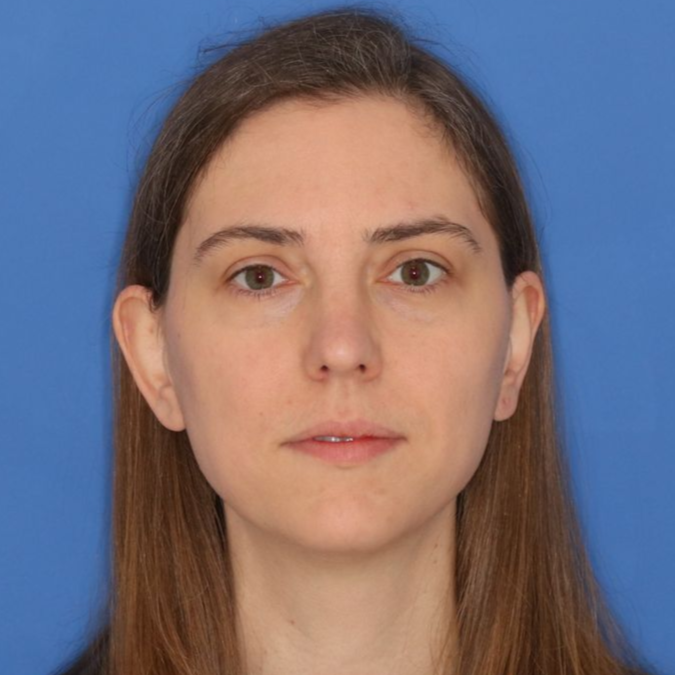 After Rhinoplasty at Carson Williams, MD Facial Plastic Surgery in Leawood, KS