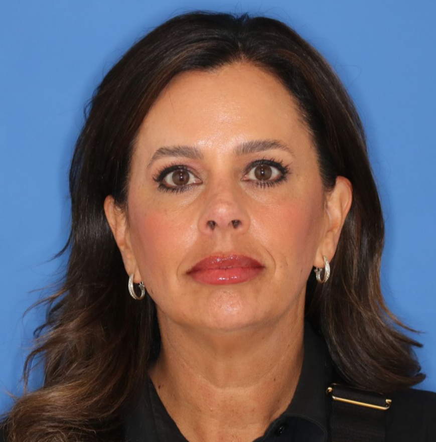 51 year old female posing for a before photo on a blue background