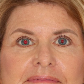 71 year old female posing on a blue background for an after photo