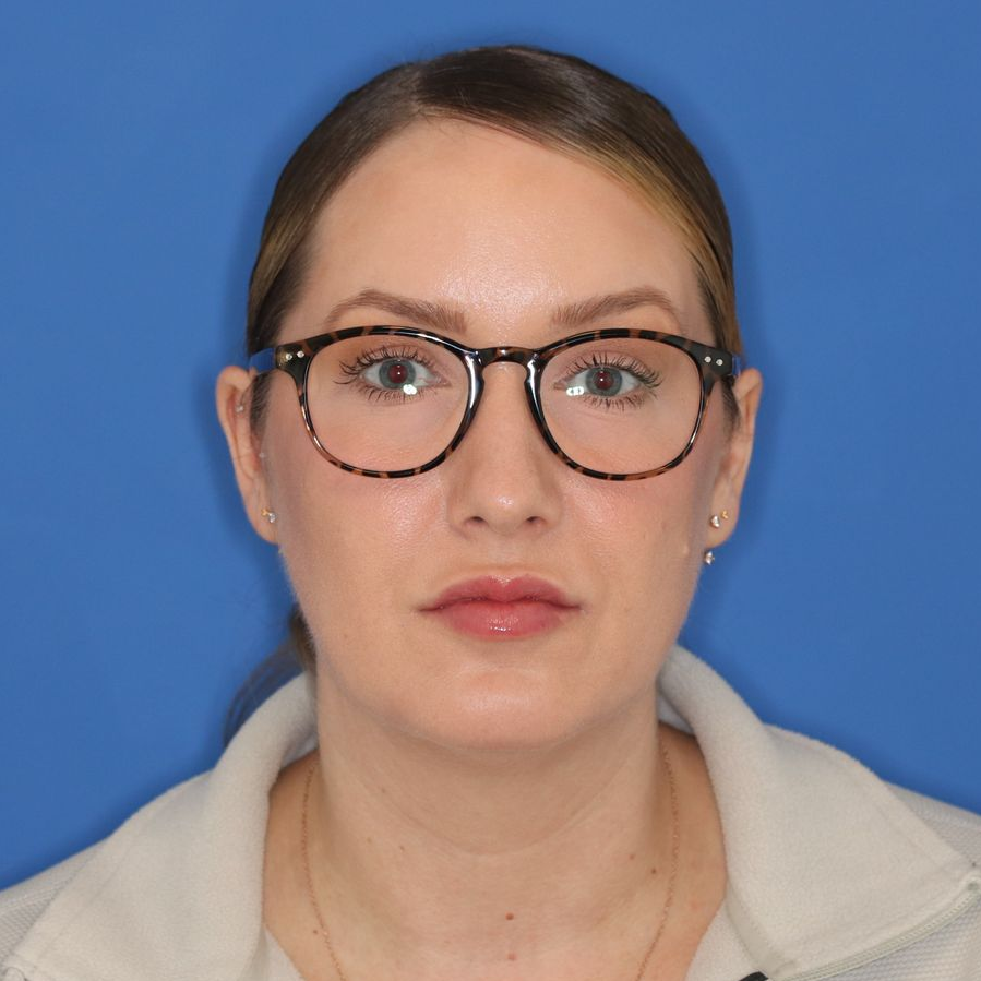 38 year old woman is standing in front of a blue background before a neck lift