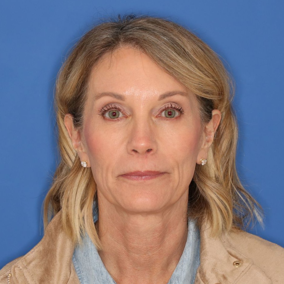 55 year old female posing for before photos on a blue background