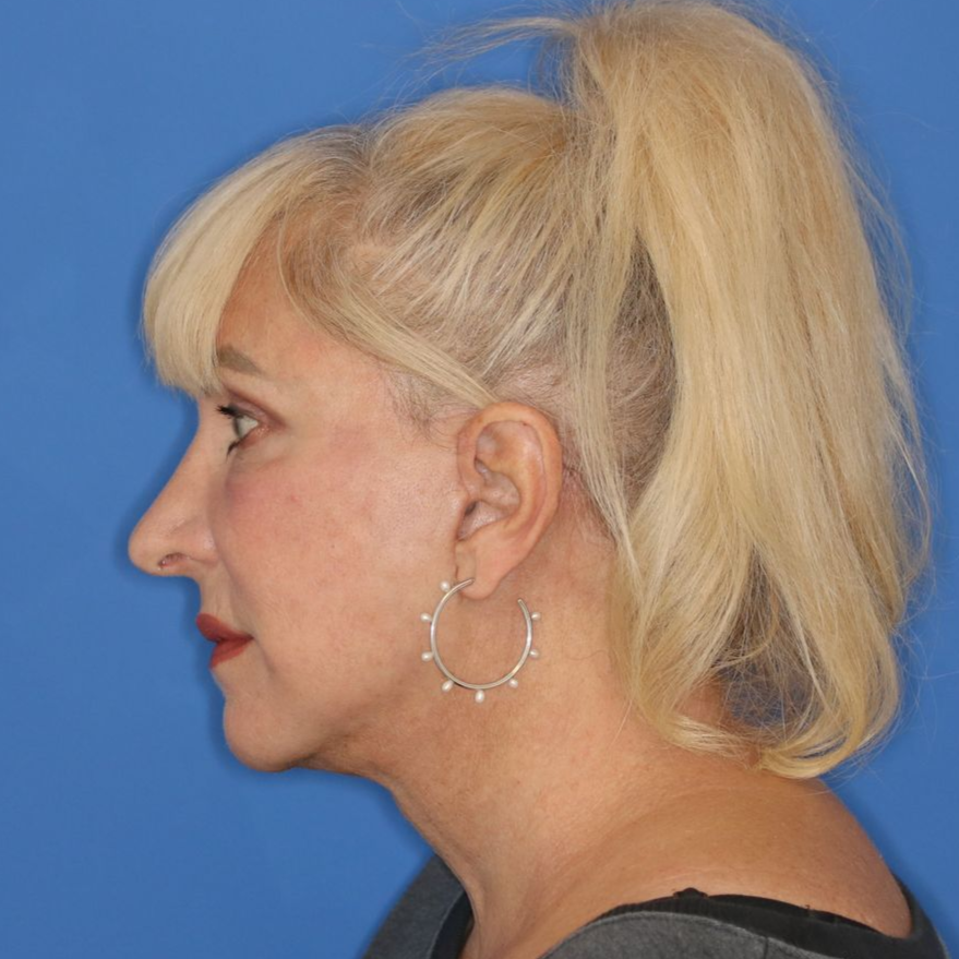 60 year old female facing to the left posing in front of a blue background