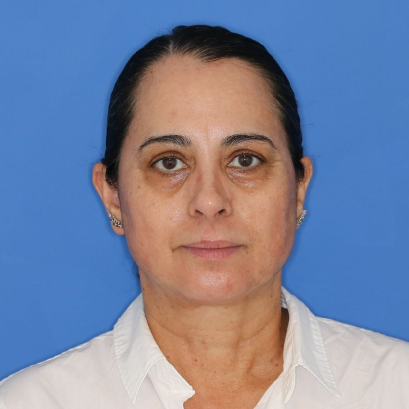 Woman for before photos on a blue background