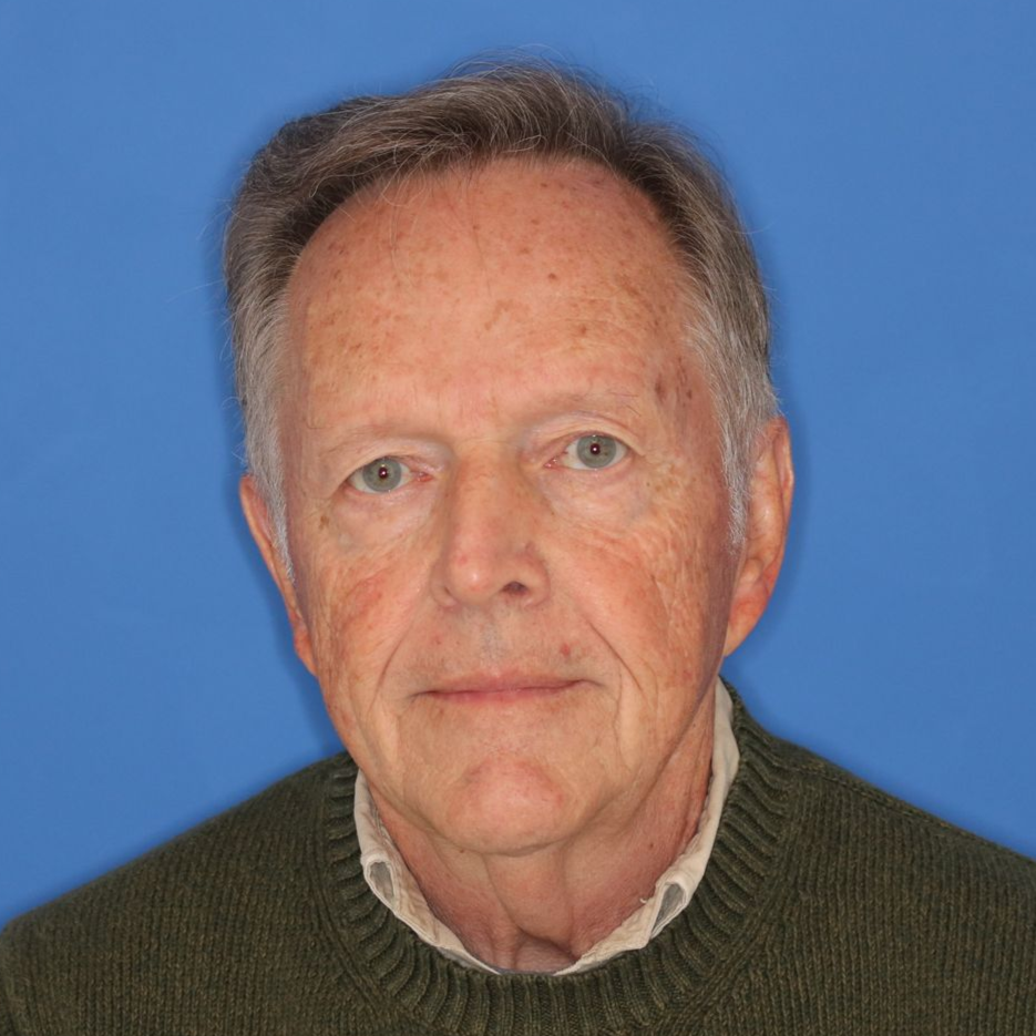 Man posing in front of a blue background before a blepharoplasty