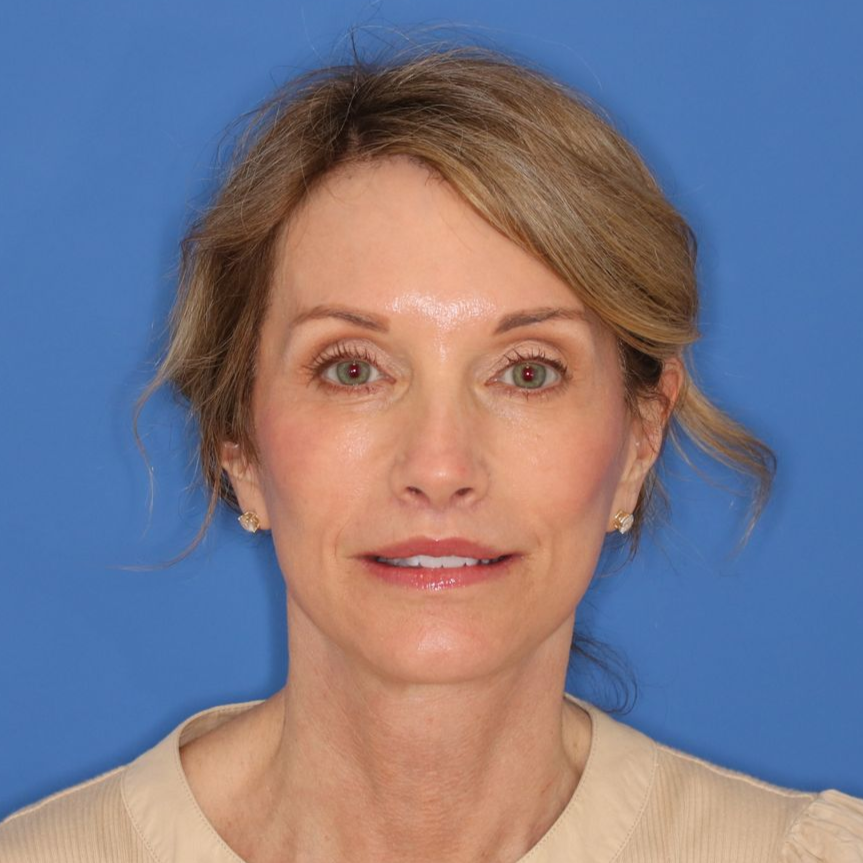 55 year old female posing for an after photo on a blue background