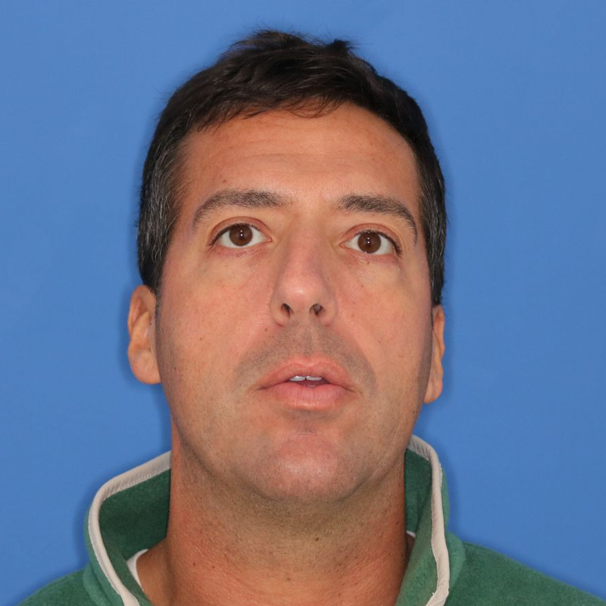 42 year old male standing in front of a blue background posing for before photos 