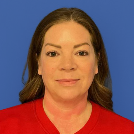 43 year old female posing in front of a blue background before surgery