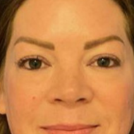 43 year old female before photo on a blue background