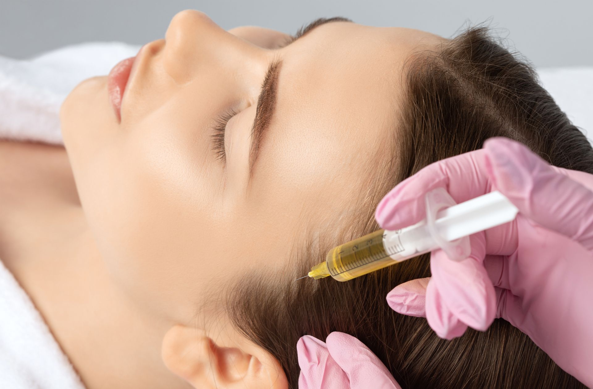 Woman receiving scalp injections; a medical professional with pink gloves injects a yellow substance into the woman's hairline.