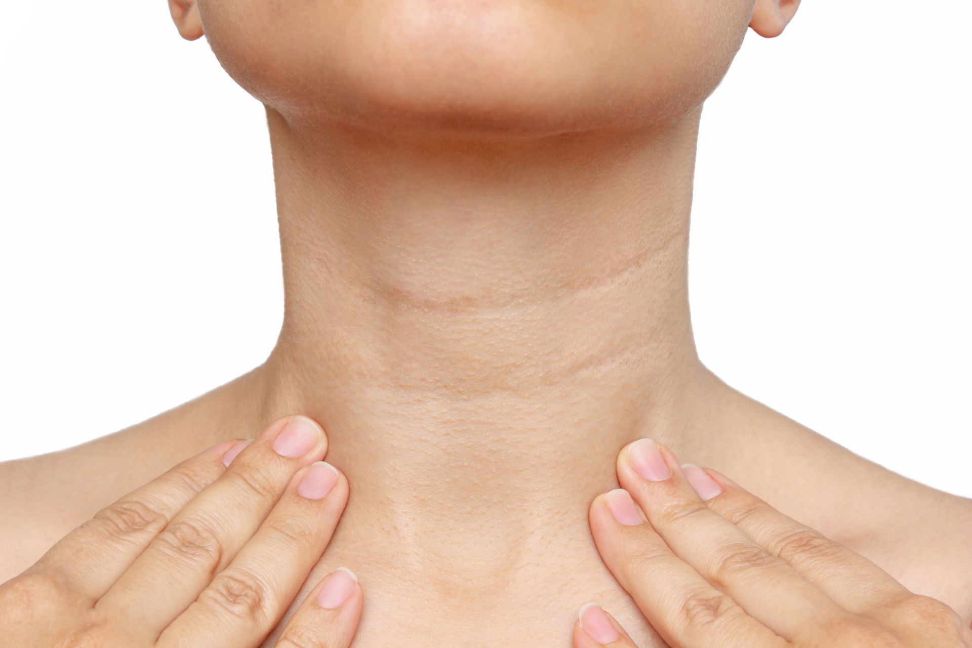 Hands pressing on either side of a woman’s neck and collarbone, suggesting a thyroid check
