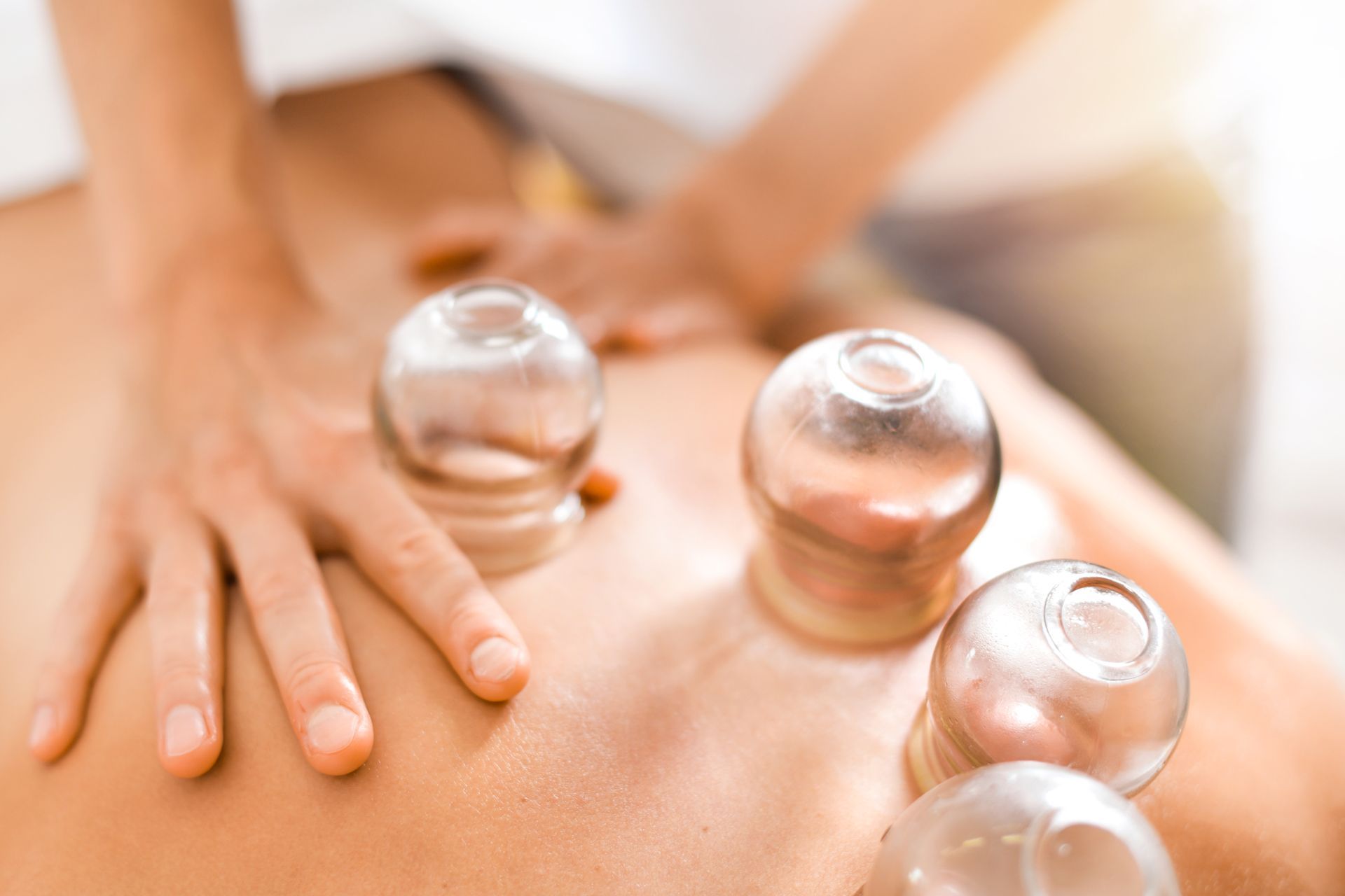 A Person is Getting a Cupping Treatment on Their Back