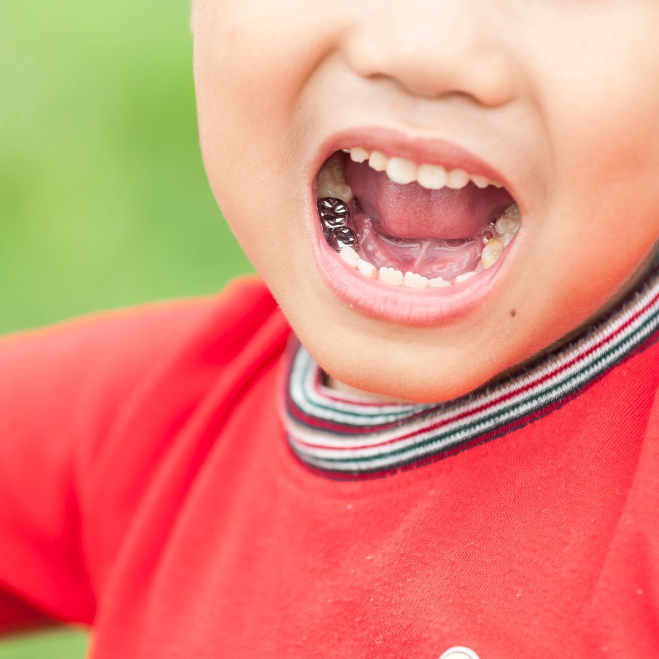 dental procedure kid
