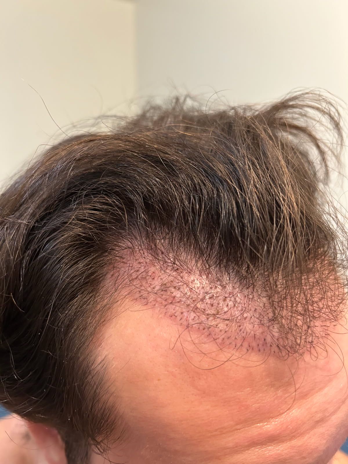 A picture of a man 's head with a clapper board in the background