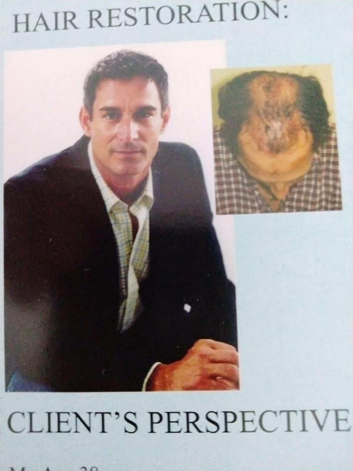 Before and After