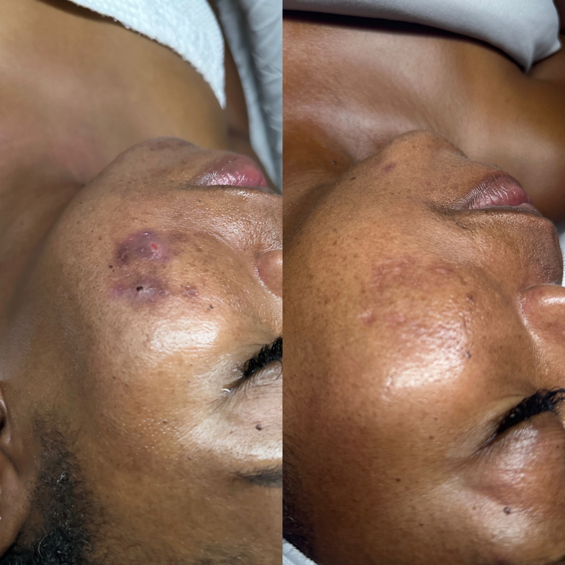 A before and after photo of a woman 's face