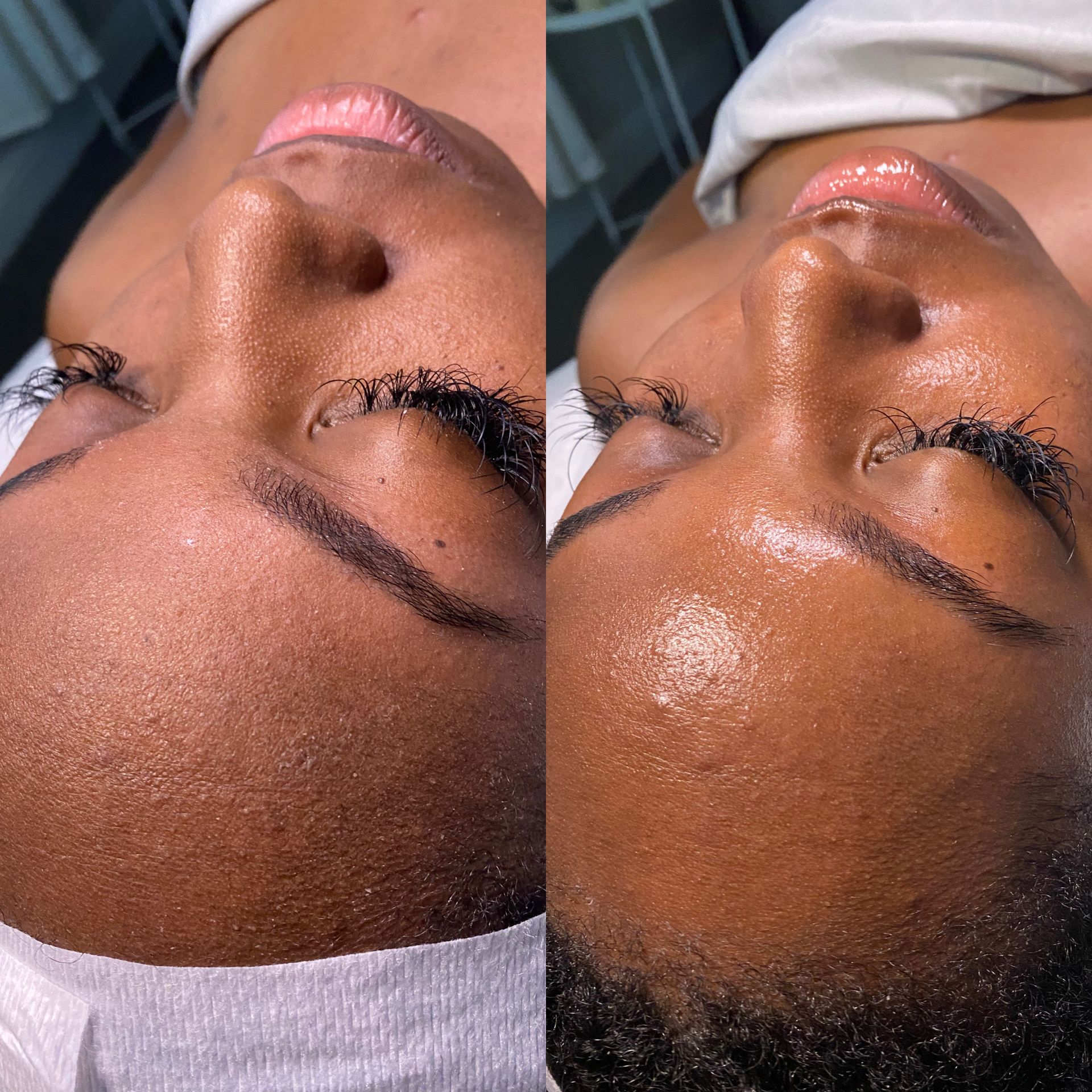 A before and after photo of a woman 's face