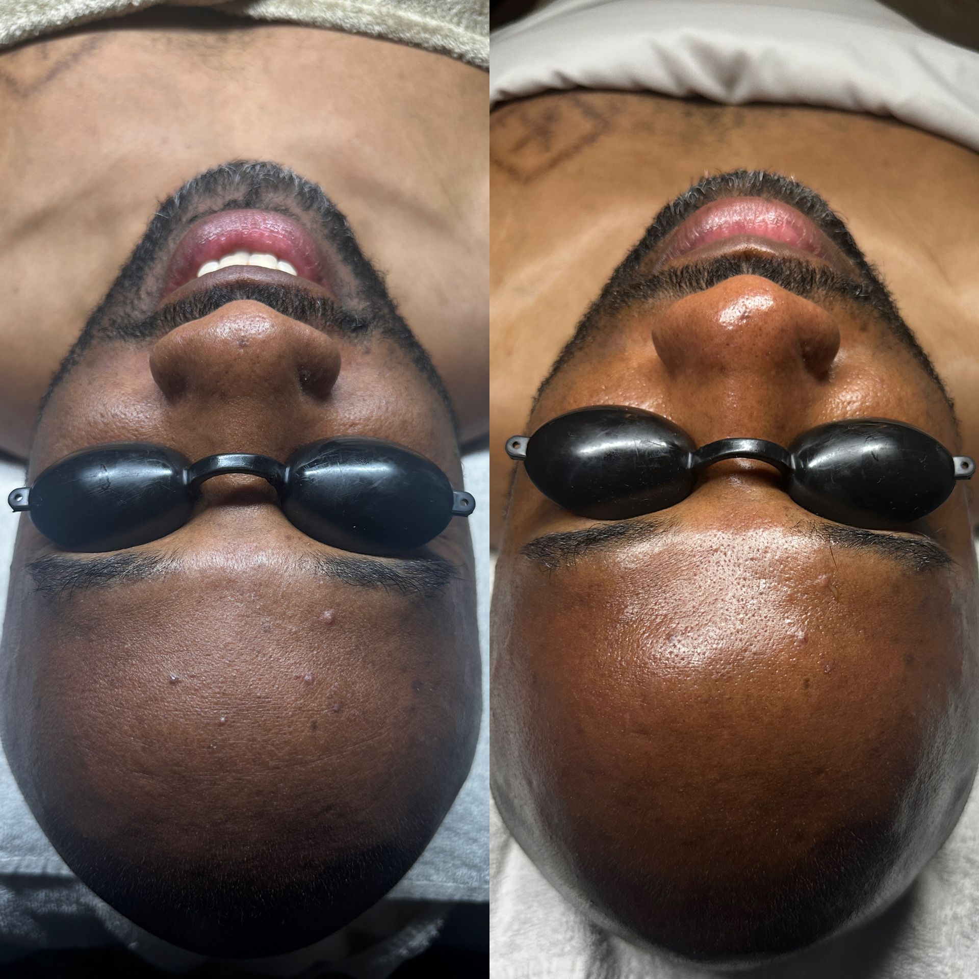 a man with before and after a treatment