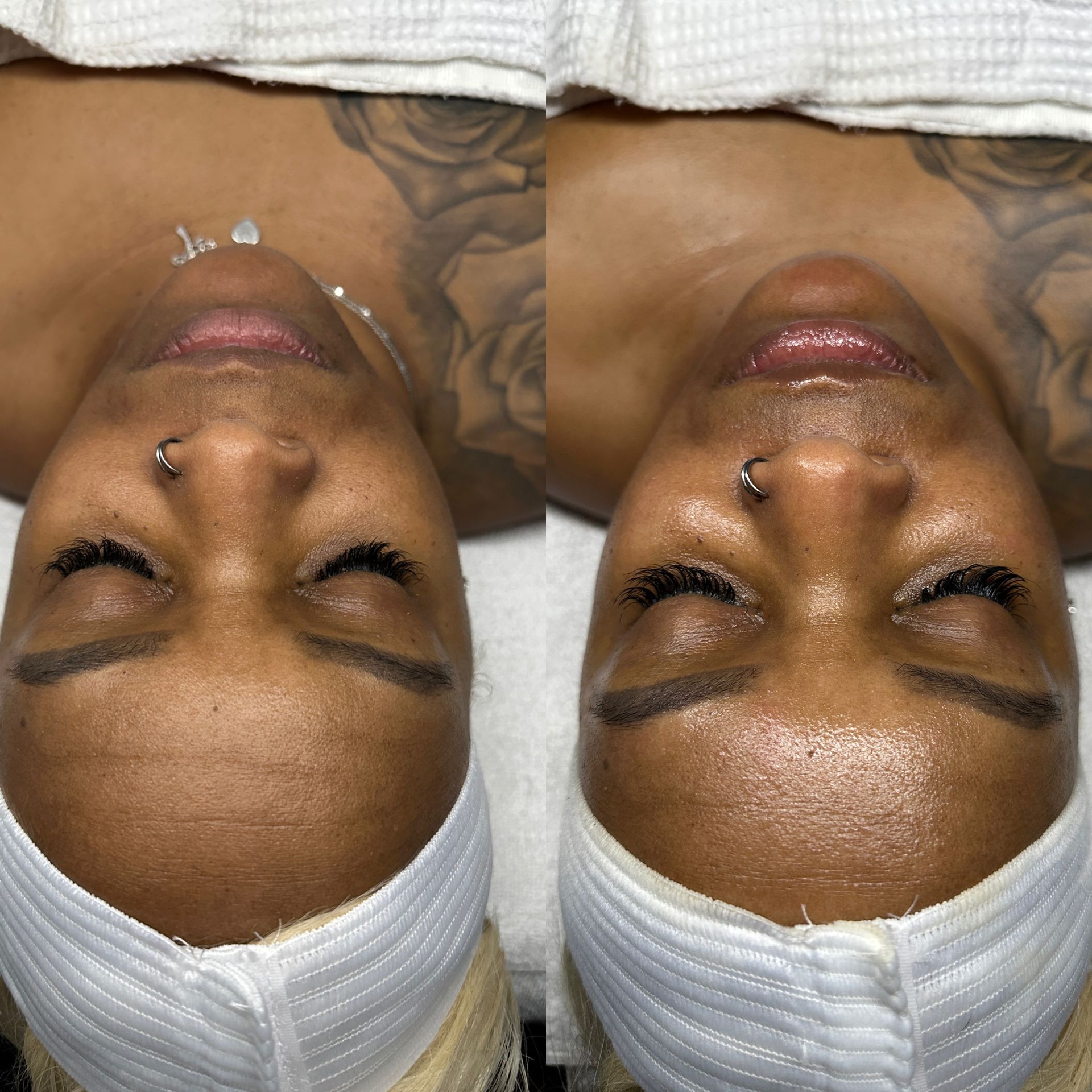 a woman with before and after a treatment