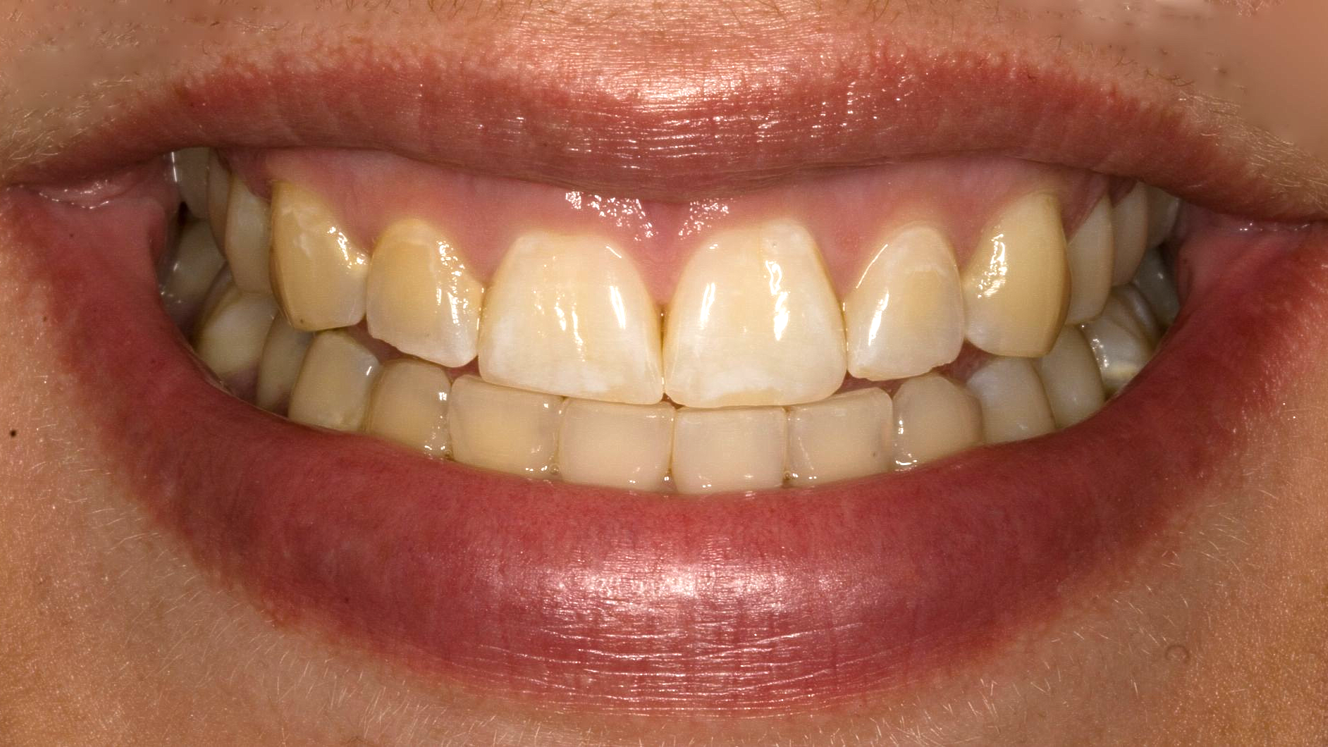 Close-up of a smiling mouth with slightly yellowed teeth and pink lips