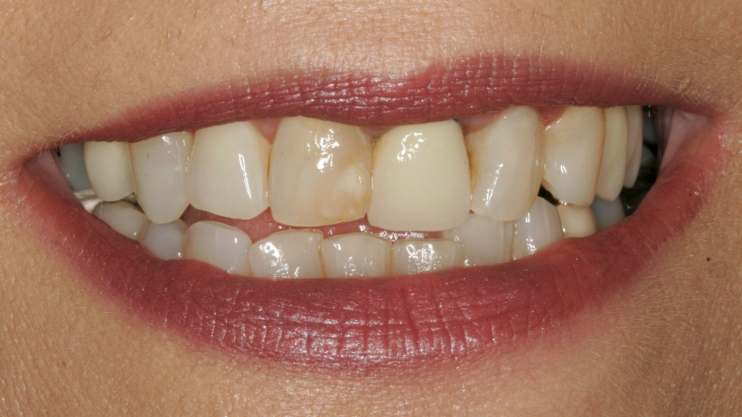 Close-up of a smiling mouth with white teeth and pink lips