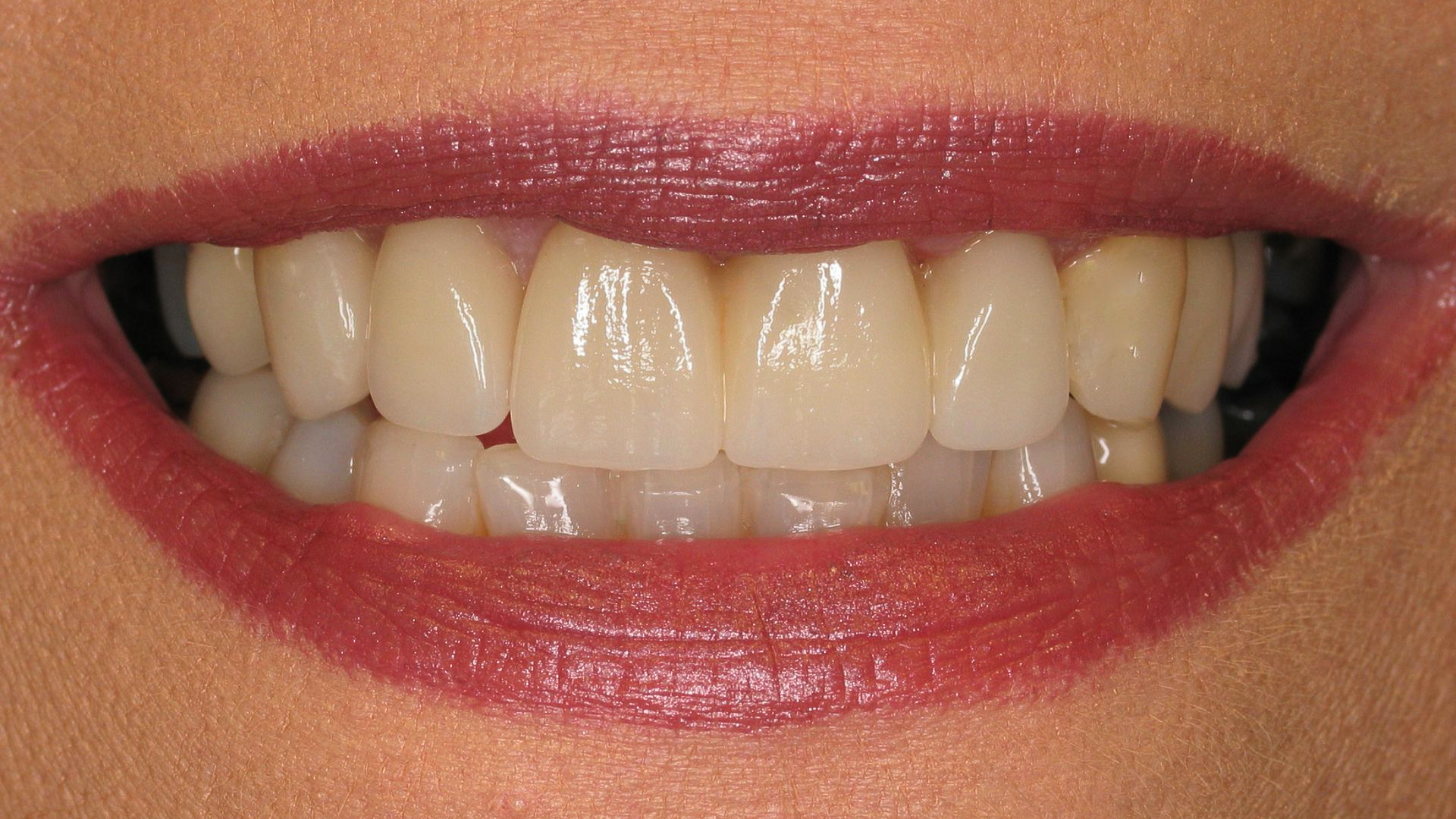 Close-up of a smiling mouth with glossy pink lipstick and visible white teeth