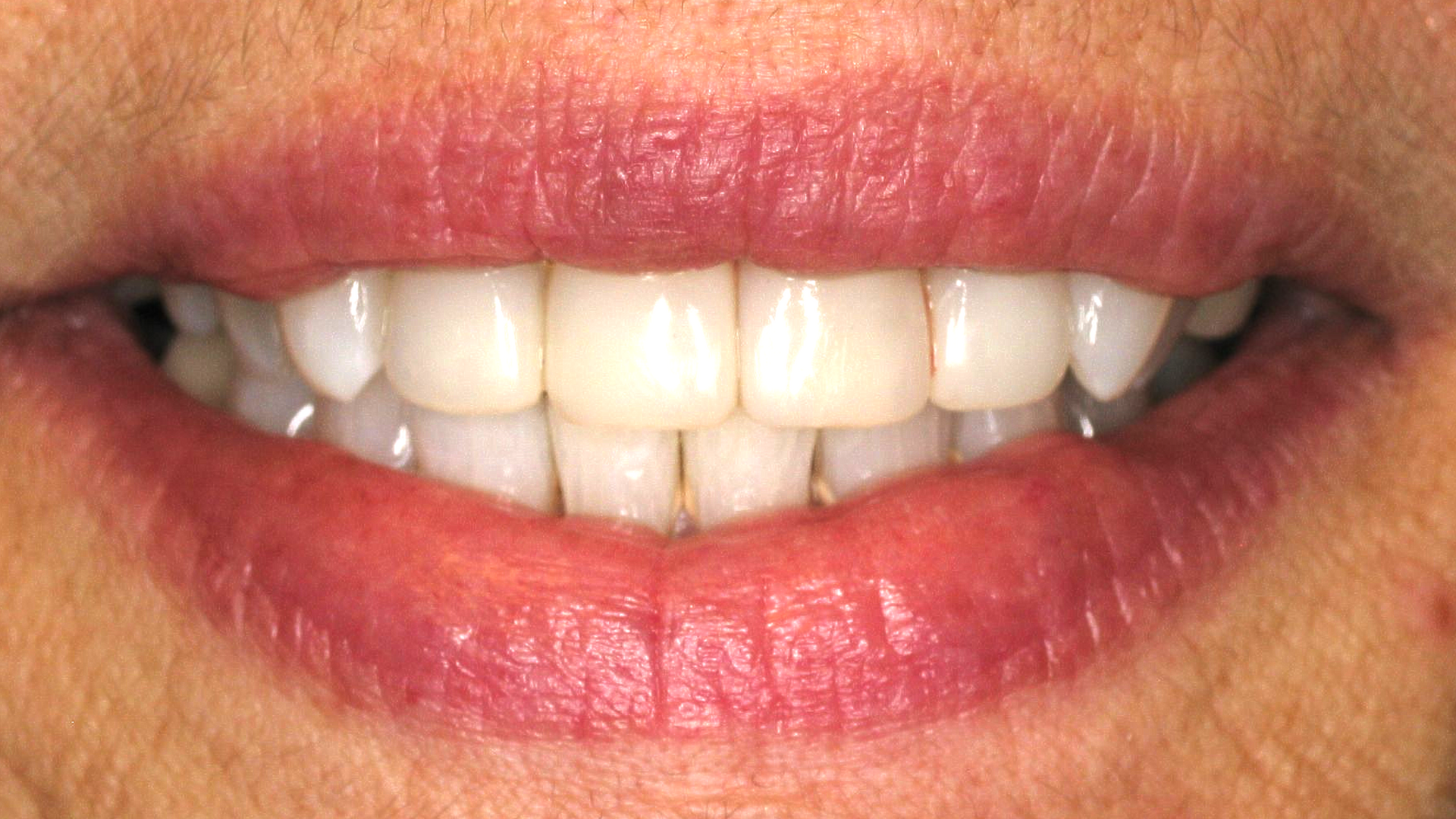 Close-up of a smiling mouth with pink lips and visible white teeth