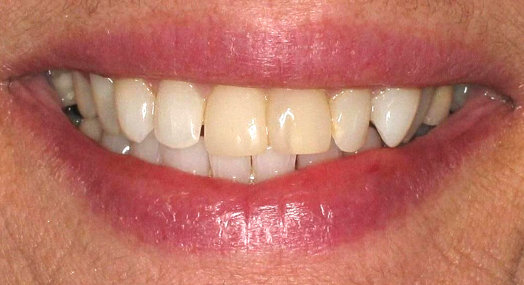 Close-up of a smiling mouth with pink lips and visible teeth