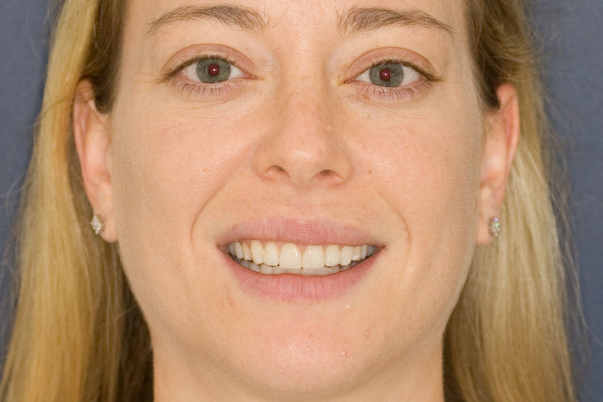 Close-up portrait of a smiling person with blonde hair against a blue background