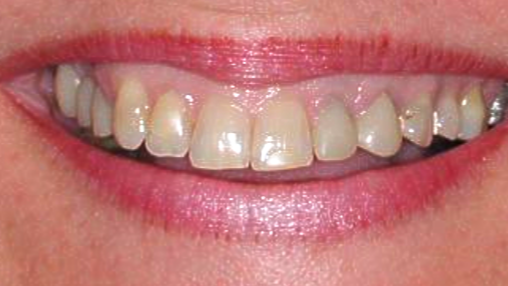 Close-up of a smiling mouth with white teeth and pink lips