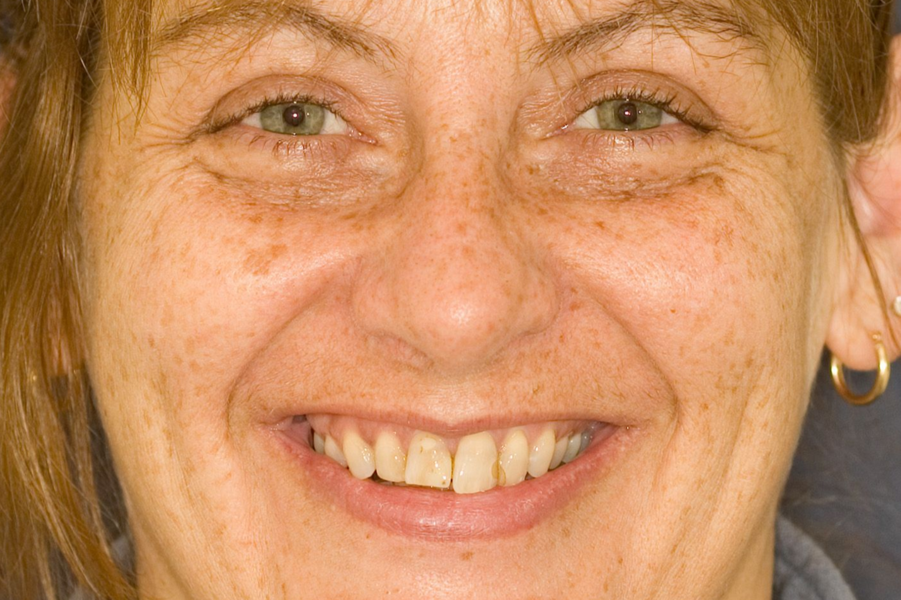 Close-up of a smiling face with freckles and hoop earrings