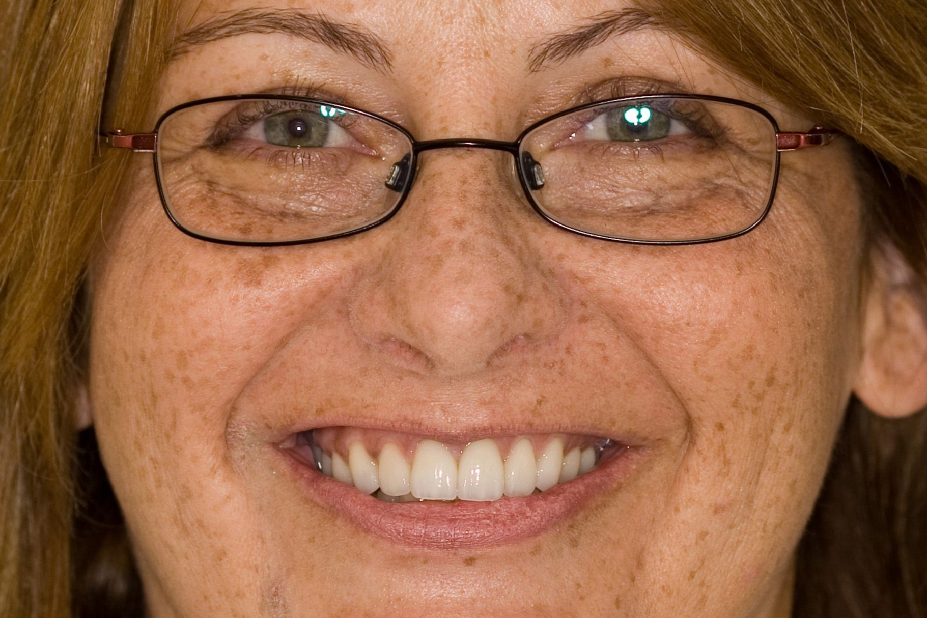 Close-up of a smiling person wearing glasses, showing freckles and teeth.