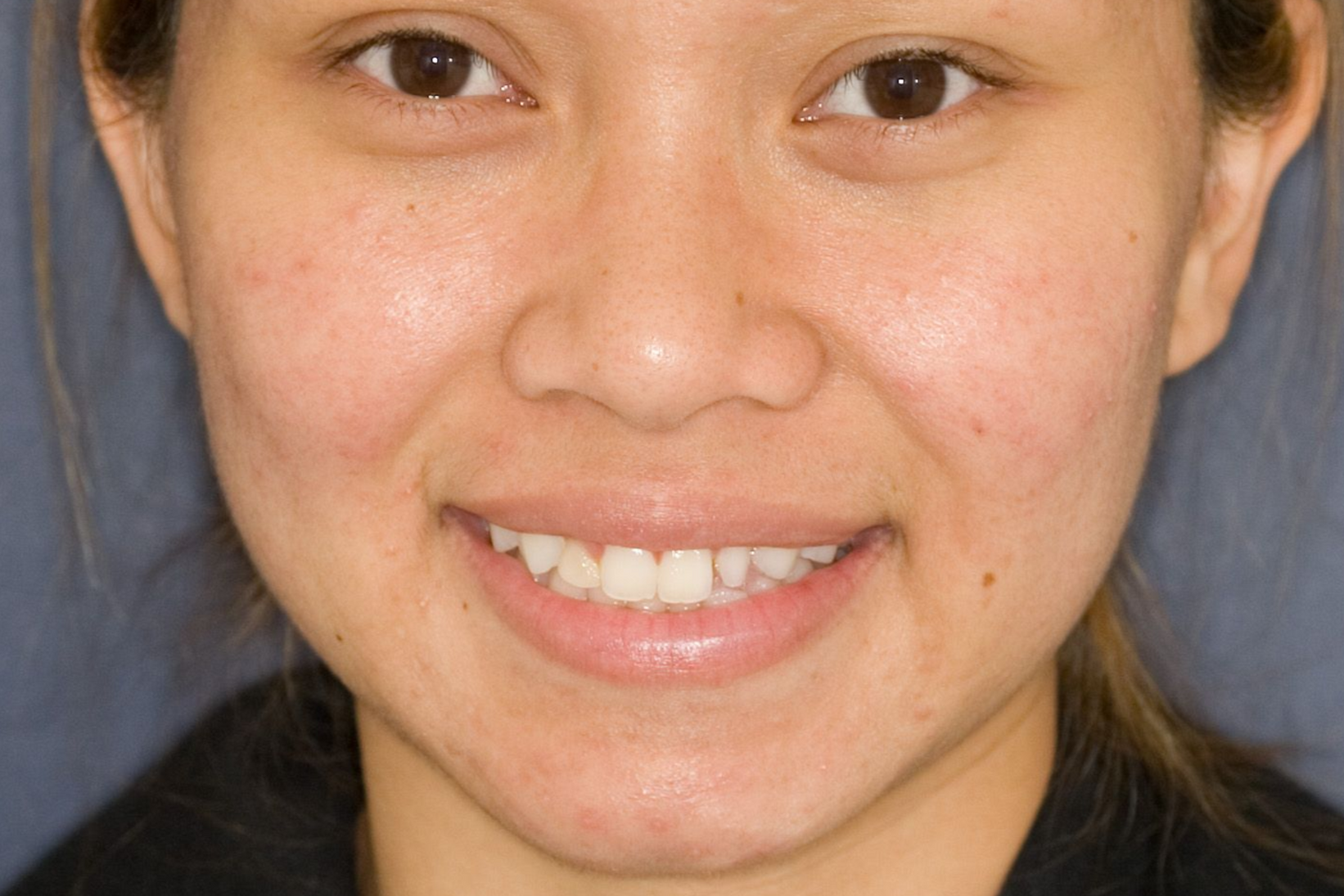 Smiling person with teeth visible against a blue background