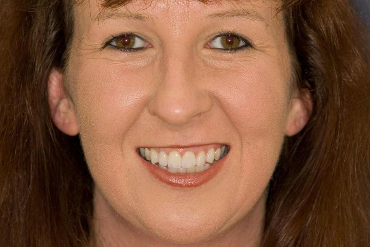 Close-up of a smiling person with brown hair against a plain background