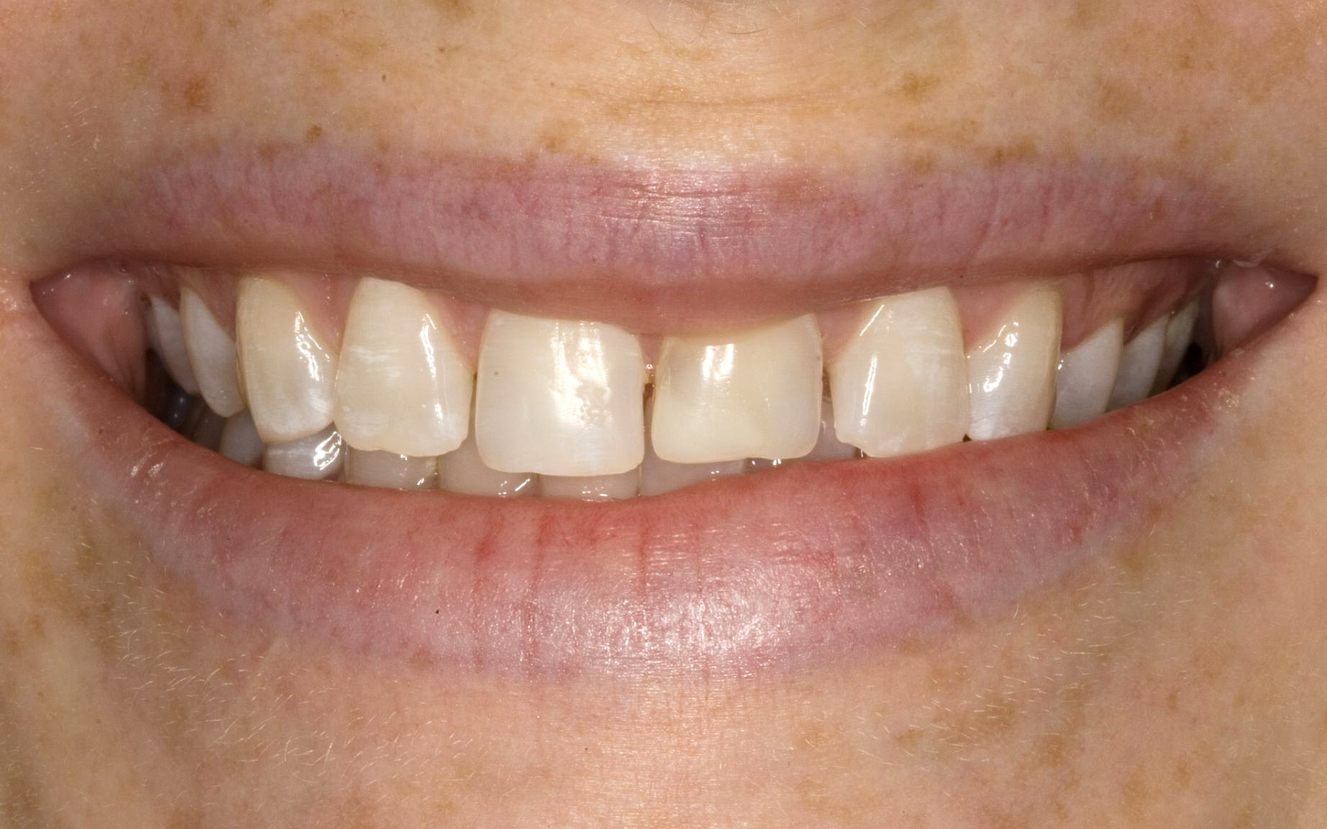 Close-up of a smiling mouth showing teeth and lips