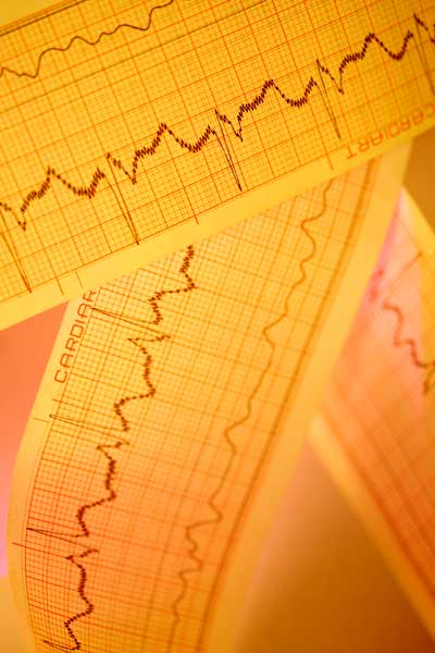 [[cms:companyname]] – electroencefalograma