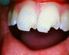 Dentist treating dental trauma