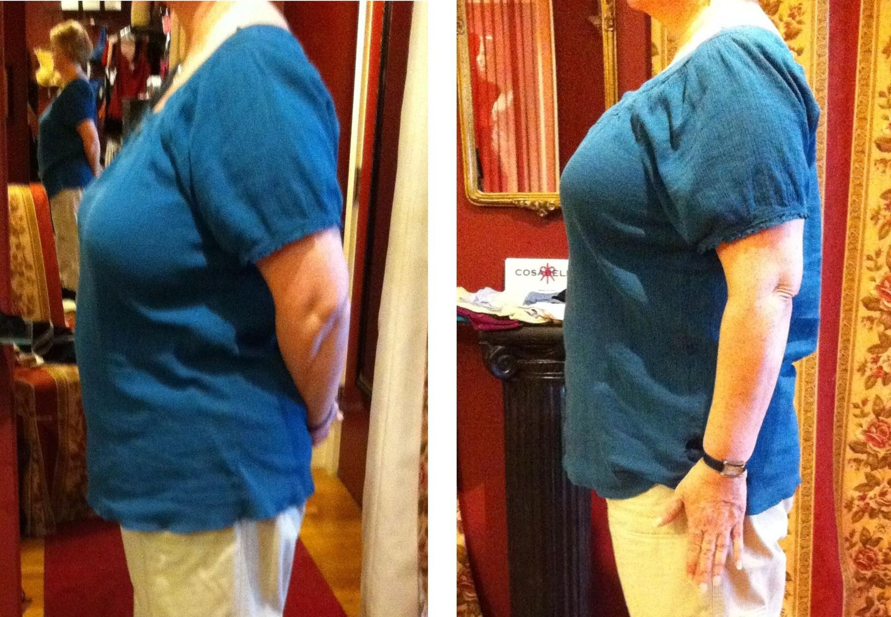 Two side-view photos, woman in blue top and khaki pants, before and after, showing a posture improvement.