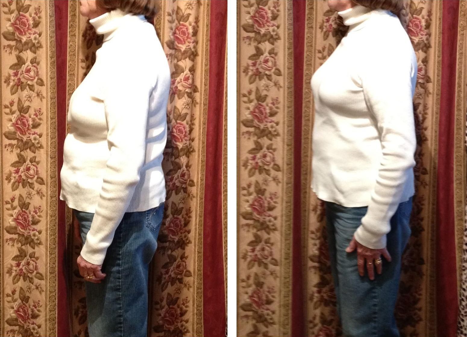 Two side-view photos of a person wearing a white turtleneck and jeans, showing posture improvement.