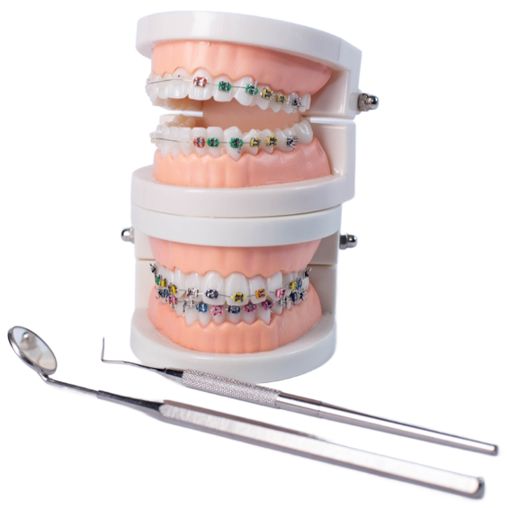 A dental model with braces and a dental mirror