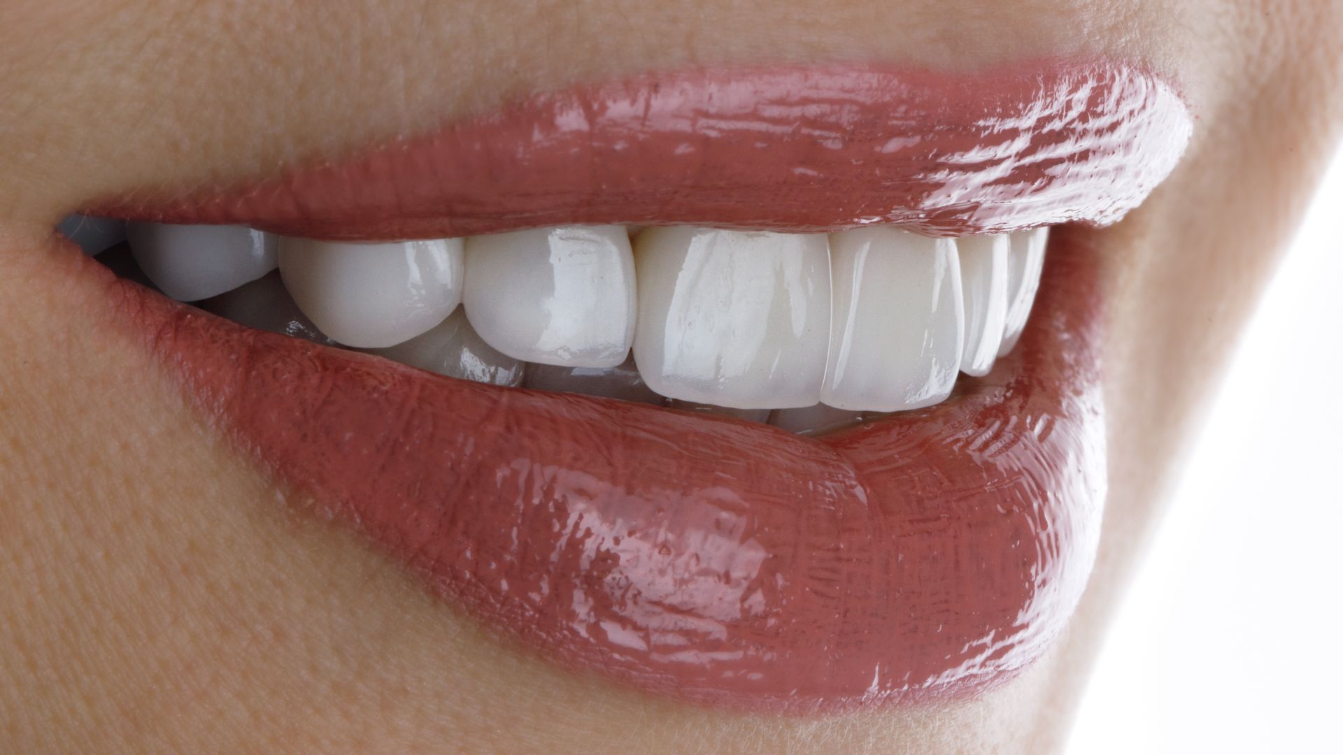 Close-up of perfect white teeth and glossy lips after professional teeth whitening.
