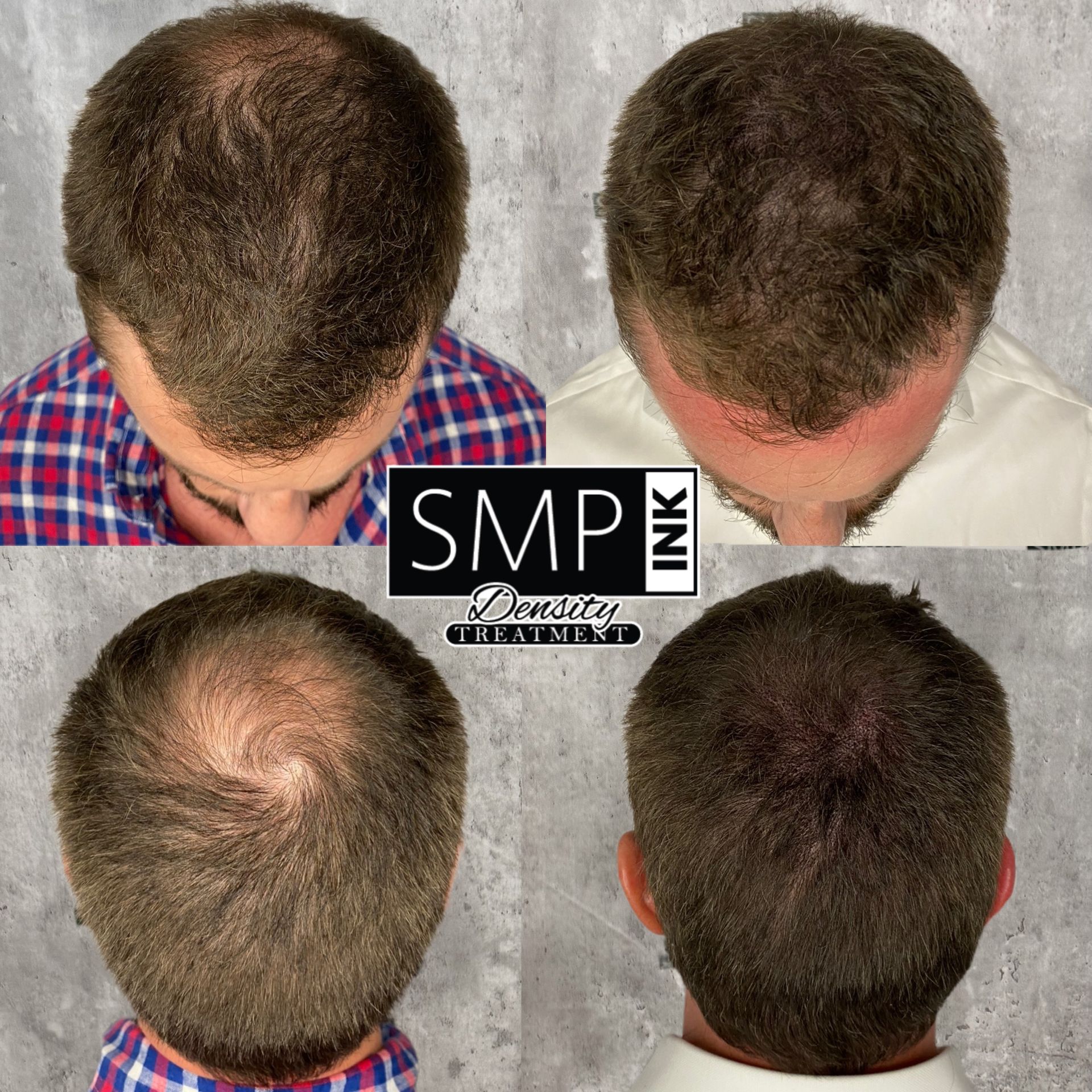 Client example of SMP Density Fill Results