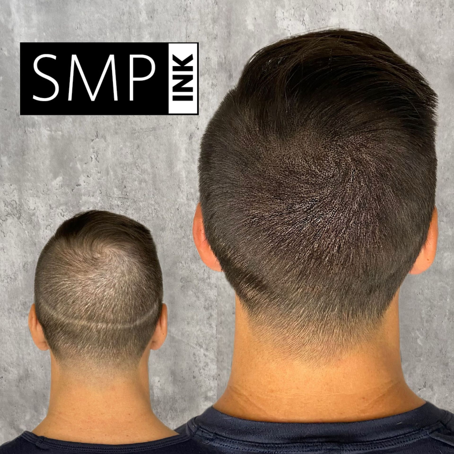 SMP Inc CDA before and after