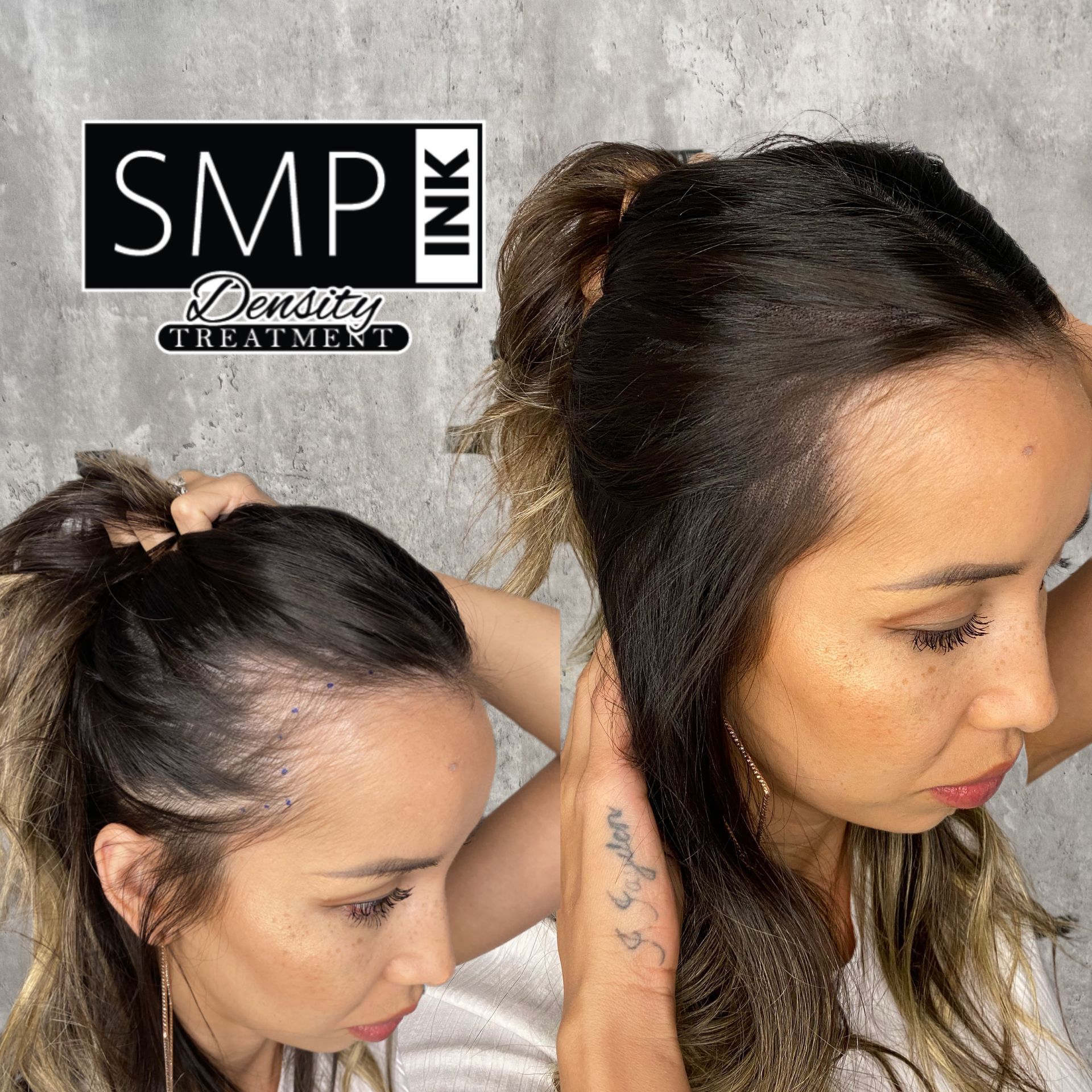 A woman before and after receiving SMP from SMP INK