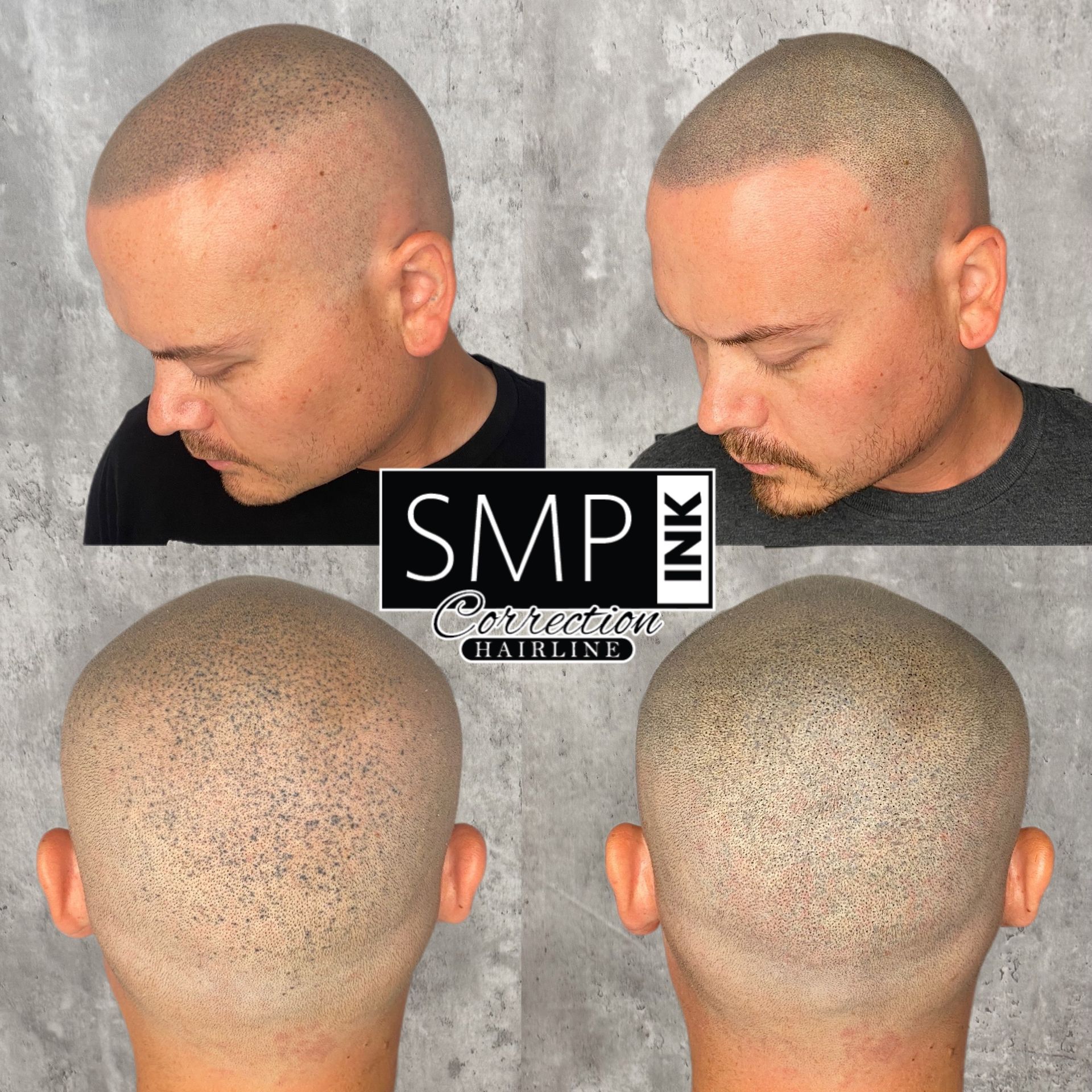 Scalp Micropigmentation | SMP INK Tennessee