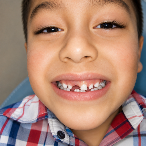 Smiling child with a gap-toothed grin in a red, blue, and white plaid shirt