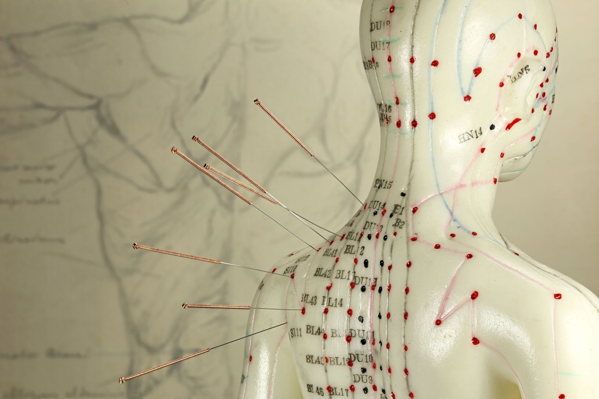 Acupuncture needles inserted into a mannequin’s upper back and neck