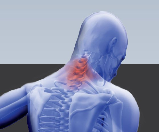 spine-neck-pain