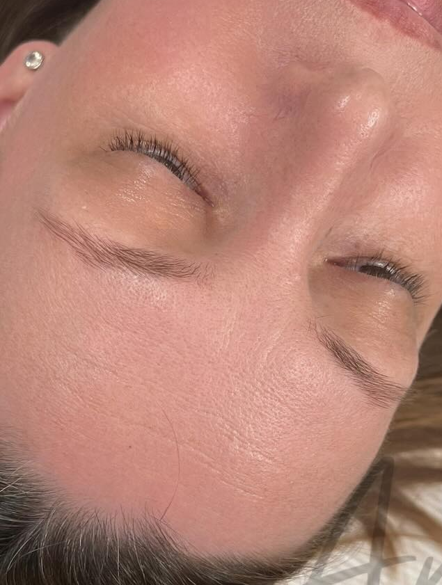 Person With Closed Eyes, Lying Down. Skin is Pink-toned — Artisan Cosmetic Tattoo & Beauty in Worongary, QLD